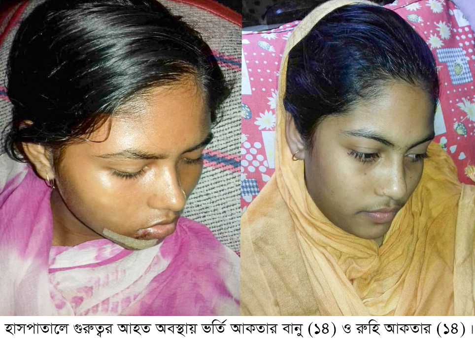 বগুড়ায় বিদ্যালয়ের সিলিং ফ্যান খুলে পড়ে গুরুত্বর আহত হয়ে হাসপাতালে ভর্তি ২ শিক্ষার্থী